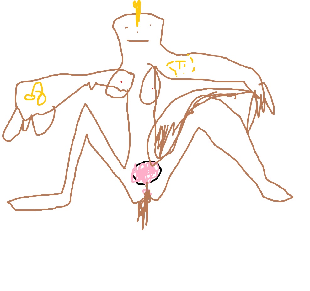 L1s0p