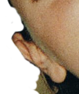 hmlIL